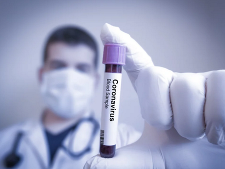 Светило по вирусология: Открити са нови симптоми на COVID-19