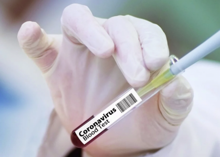 Тийнейджър на 15 донесе коронавирус от Холандия в Хасково