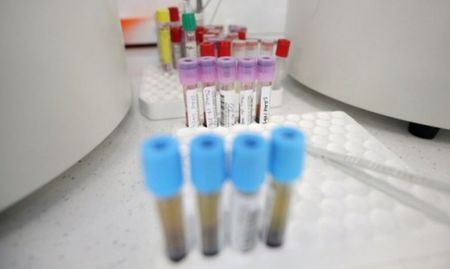 Позитивният PCR тест не означава, че има заразен с вирус