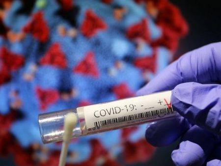 75 са новозаразените с коронавирус през последното денонощие