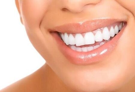 12 храни за естествено избелване на зъбите