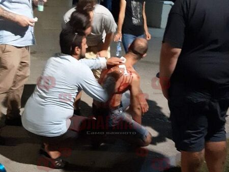 Среднощен екшън в Морската градина в Бургас, мъж е наръган 4 пъти в гърба