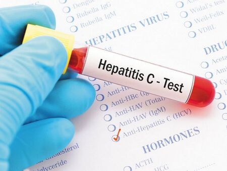 Близо 80 000 българи са болни от хепатит С
