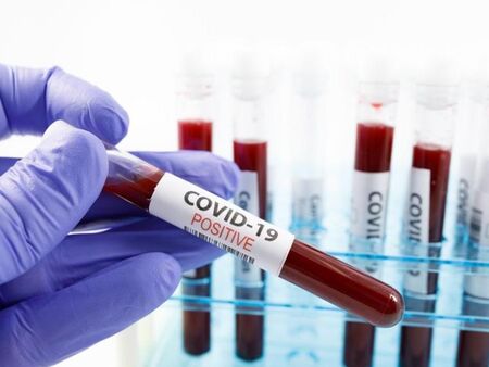 182 нови случаи на COVID-19 у нас, в Бургас - едва 6 положителни проби