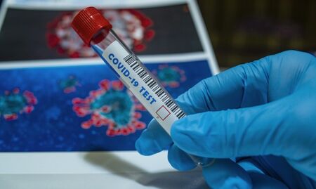 BG ваксината срещу коронавируса готова до края на годината