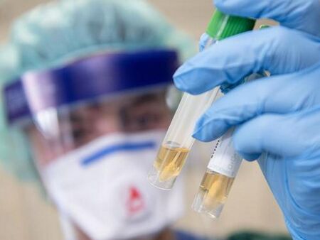 Спад на новите случаи на коронавирус, в Бургаско положителните проби са 5