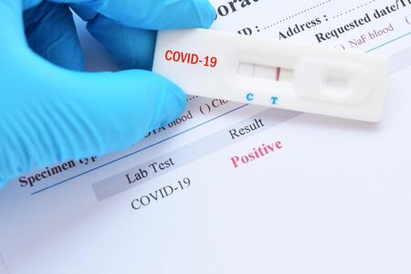5 симптома на коронавирус, при които можем да си направим PCR тест с направление
