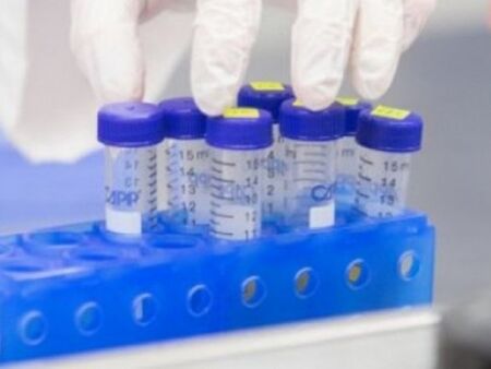 296 излекувани от коронавирус, 233 са новите потвърдени случаи