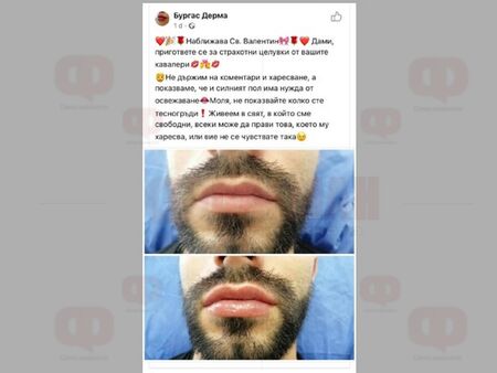 Бургаско студио слага с отстъпка филъри на мъжки устни за Св. Валентин