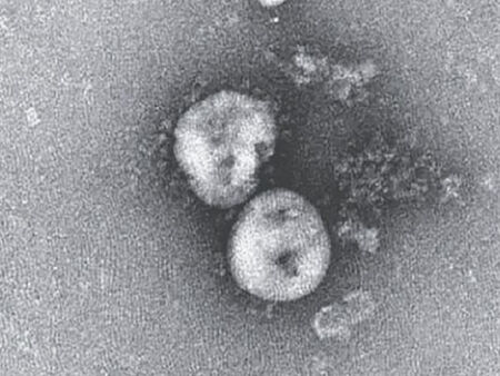 Фантомният вирус: В търсене на SARS-CoV-2*