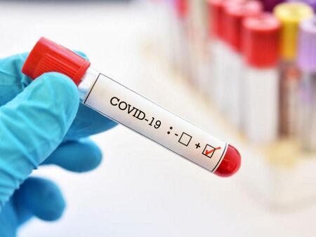 Жена на 41 години е сред починалите с COVID-19 през денонощието