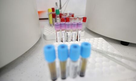 Румъния отчете рекорден брой заразени с коронавирус