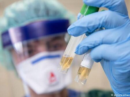 2537 са новите положителни проби за коронавирус, починали са 49 човека