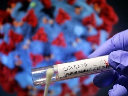 1 708 са новите случаи на коронавирус, 751 души са в интензивно отделение