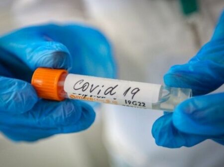 518 са новите случаи на коронавирус, в интензивните отделения са 504 души