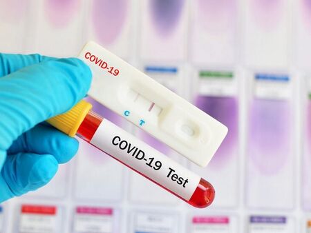 Турски тест за коронавируса дава 99% сигурност за 10 сек