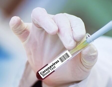 Учени: Възможна е комбинирана ваксина за грип и COVID- 19