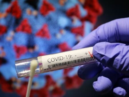 3146 са новите случаи на коронавирус, в Бургас - 137