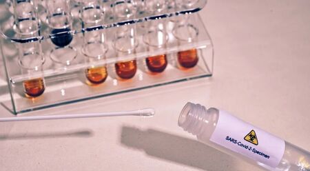 Създадоха PCR тест, показващ колко е болен заразеният с коронавирус