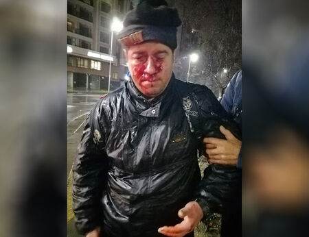 Мъж си разби главата, падна в дупка на булевард в Пловдив