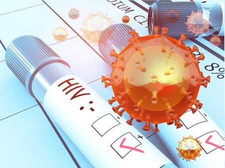 Учени: Трети човек с ХИВ е излекуван напълно