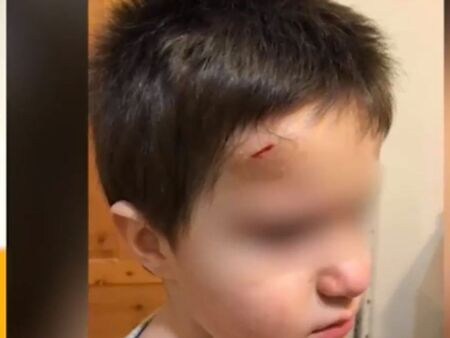 Близнаци тормозят деца, забиха молив в челото на момче