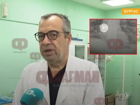 Рядка уникална операция завършила с щастлива развръзка но медиците споделят