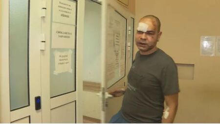 Нападнатият медик във Враца: Главоболието е много силно, избити са ми зъби