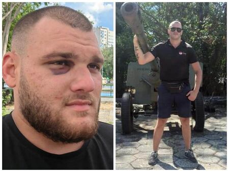 Подал съм жалба срещу Виталий Вухряков имам средна телесна повреда