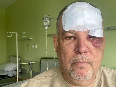 Защо този общински съветник в Бургас е с насинено око и шито чело