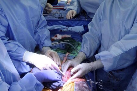 Шест седмици след операцията: Почина вторият пациент с трансплантирано сърце от прасе