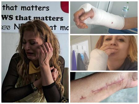 Ексклузивно! Шокиращата изповед на Маргарита – медицинската сестра, пребита от пациент на Психото в Бургас