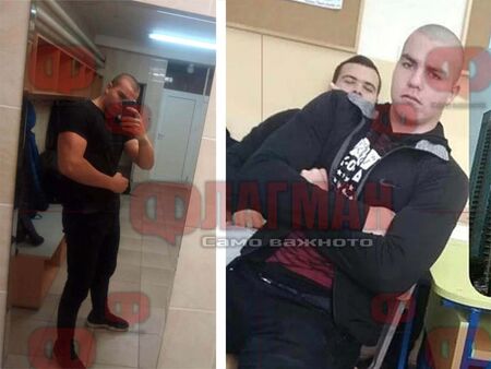 Ето го полицая от Четвърто РУ-Бургас, който счупи челюстта на младеж на Джулая