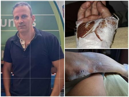 Бабаит пребил жестоко ивент мениджъра Марио Ангелов, размятал му презерватив: „С това ли ще е... жена ми?“