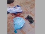 Тийнейджър полетя от терасата на хотел в Приморско, парапетът се изкъртил, докато се подпира на него