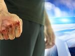 Заради забележка: Мъже пребиха дядо, в кома е
