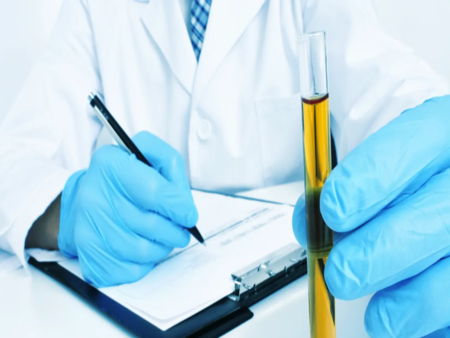 Признаци, че имате прекалено много пикочна киселина