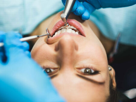 Почти двойно поскъпване на стоматологичните услуги, зъболекарите оспорват данните