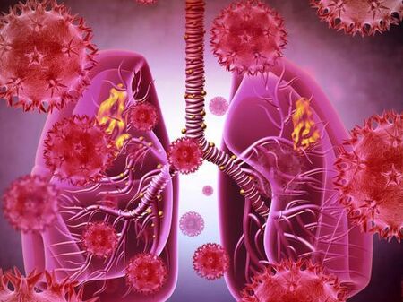 За първи път след COVID-19 СЗО издаде предупреждение заради MERS