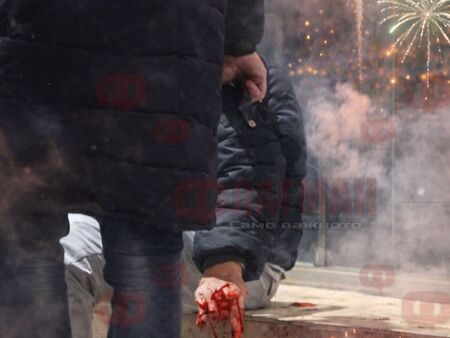 Новогодишен ужас в Равда: пиратка избухна в ръката на момче