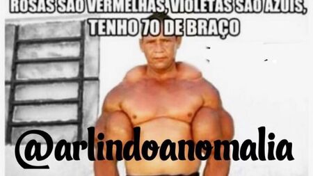 Почина „бразилският Попай“, инжектирал си в бицепсите минерално масло и алкохол