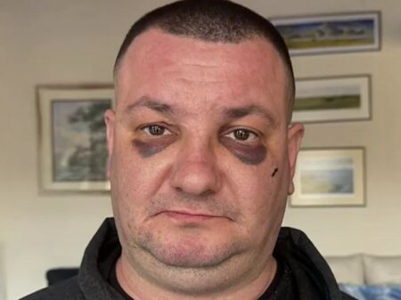 Брутален бой в дискотека. Кристиян твърди, че е завързан с белезници и ритан в главата