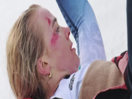 Разкриха "специално" желание на Линдзи Вон в медицинския хеликоптер