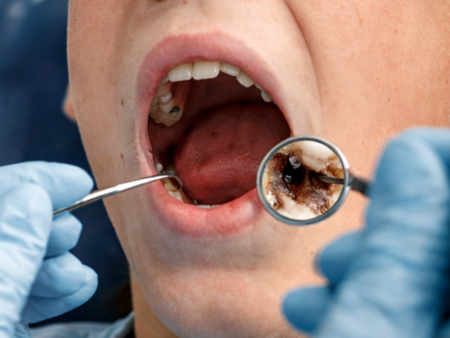 Правителството отпусна над 7 млн лв за подобряване на оралното