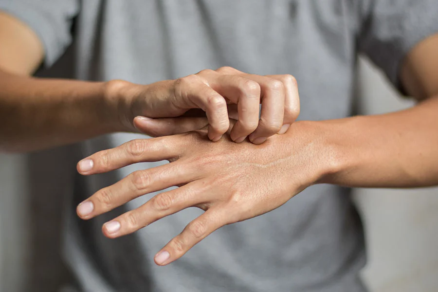 Краста плъзна в Европа