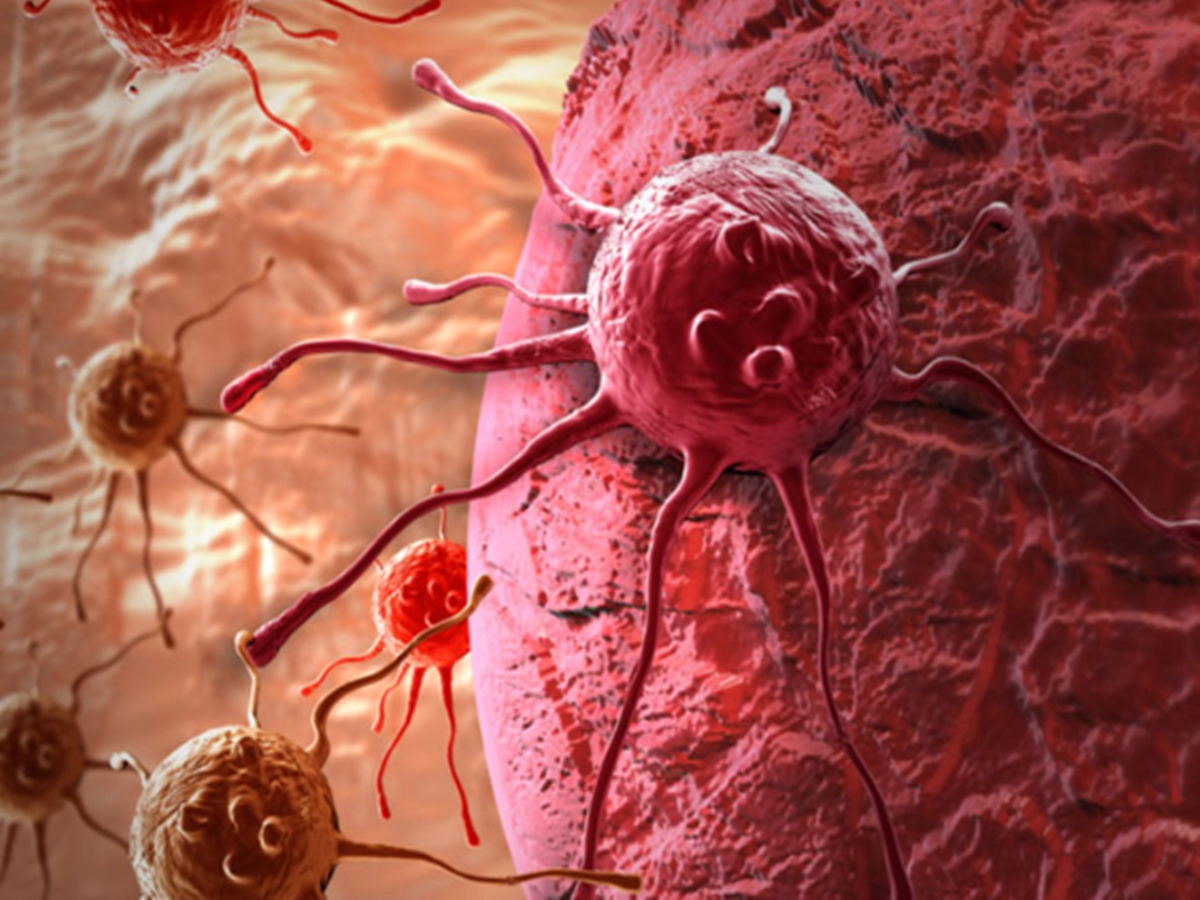 Учени: Няма доказателства, че стресът повишава риска от рак