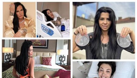 Нова мода сред звездите - махат си силикона