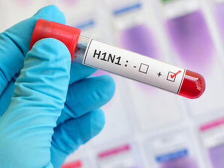 Потвърдиха първия H1N1 за сезона у нас: Пациентка е приета в инфекциозна болница